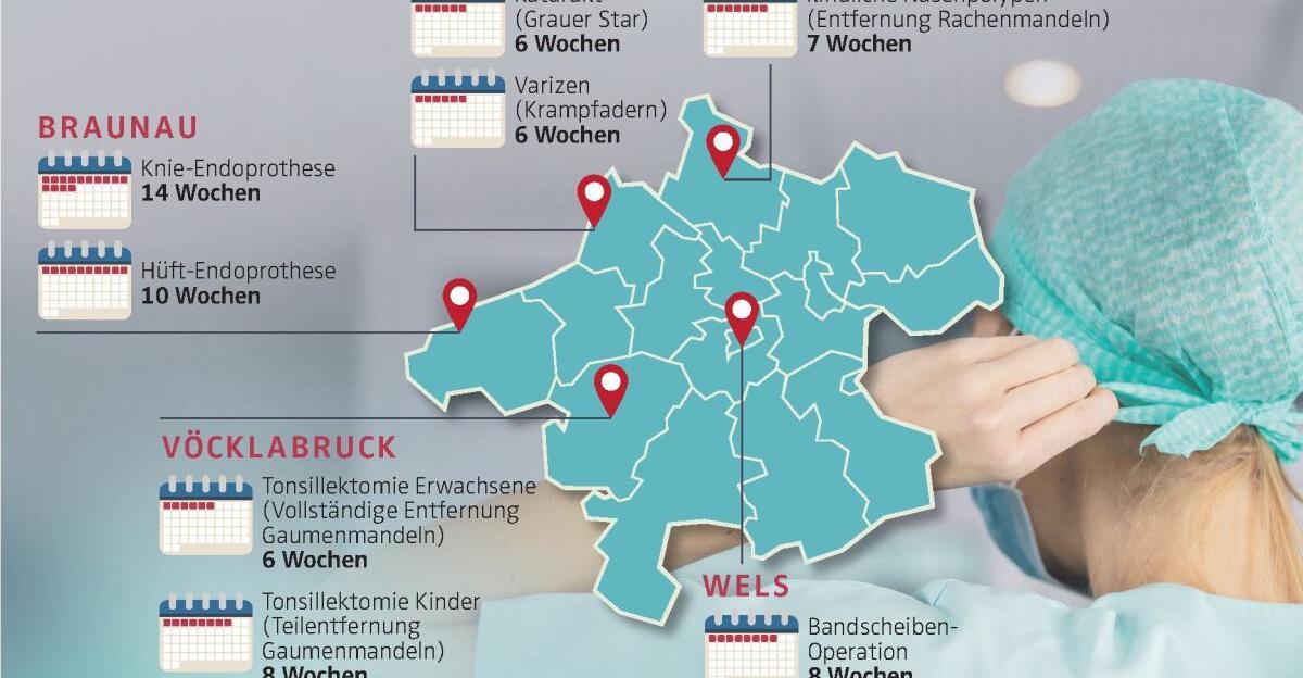 wie-lange-sie-auf-einen-operationstermin-warten