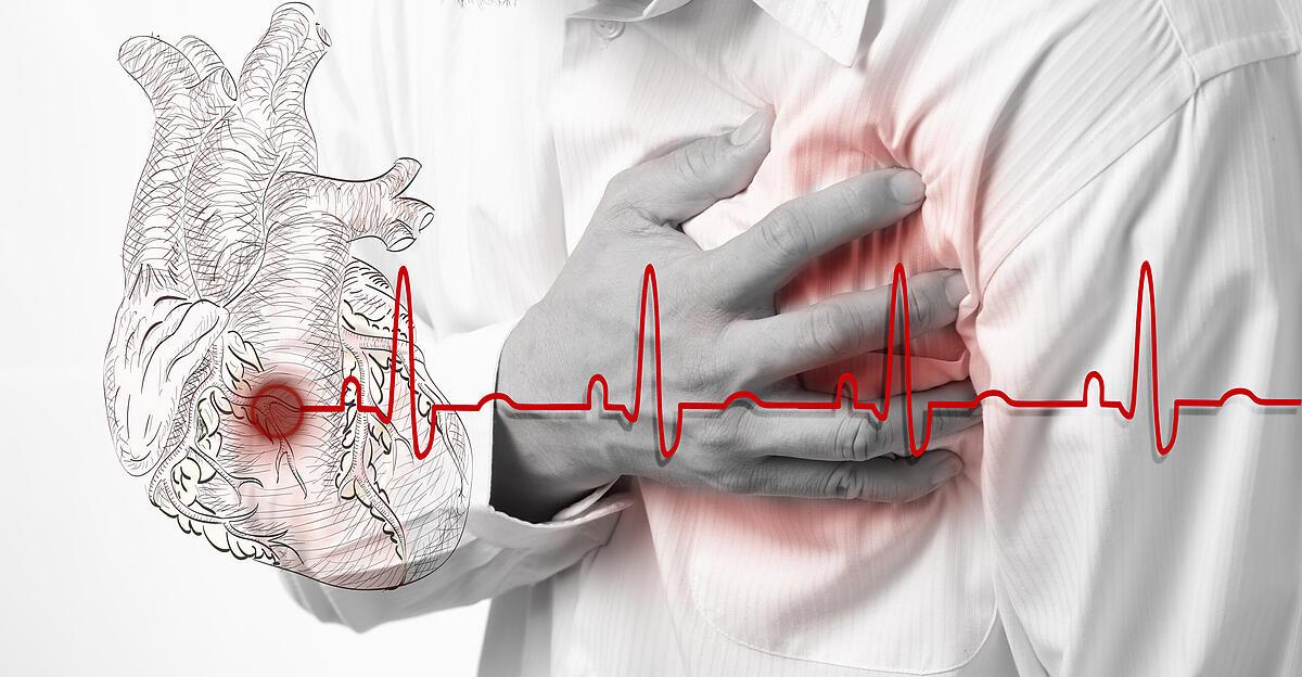 Crise cardiaque : le traitement de suivi est souvent insuffisant |  Nachrichten.at