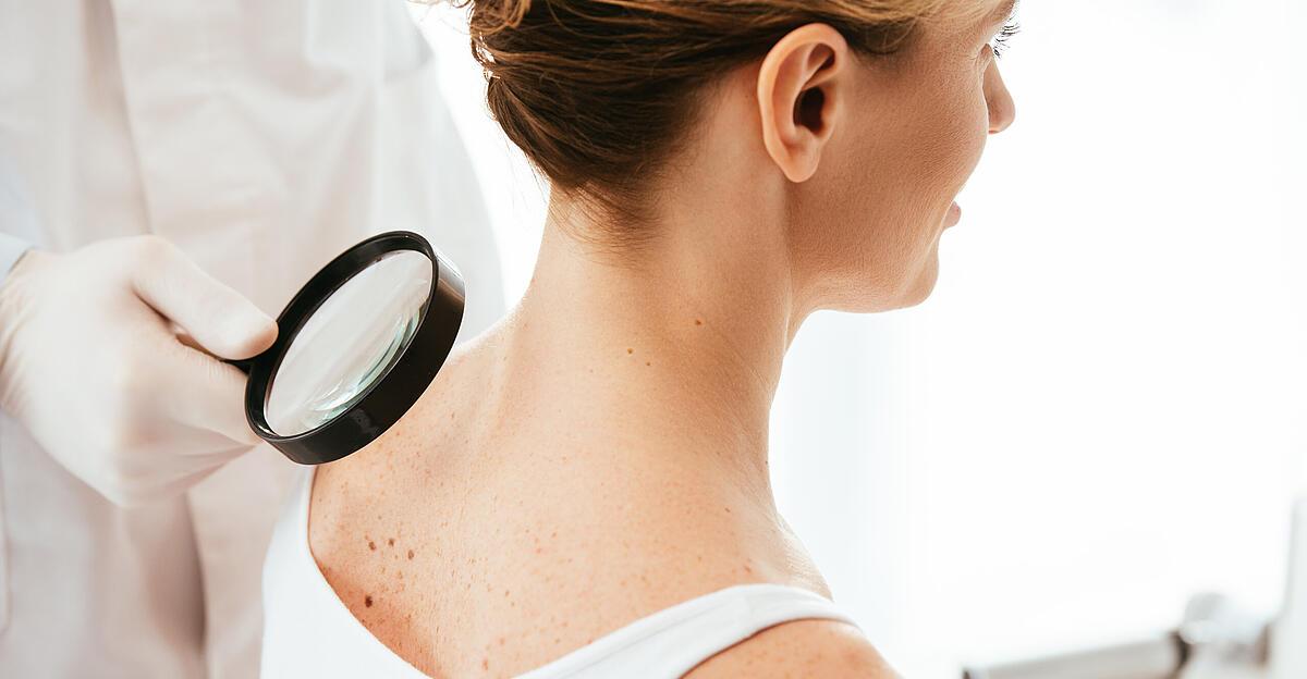 Les applications d’IA détectent le cancer de la peau avec autant de fiabilité que les médecins