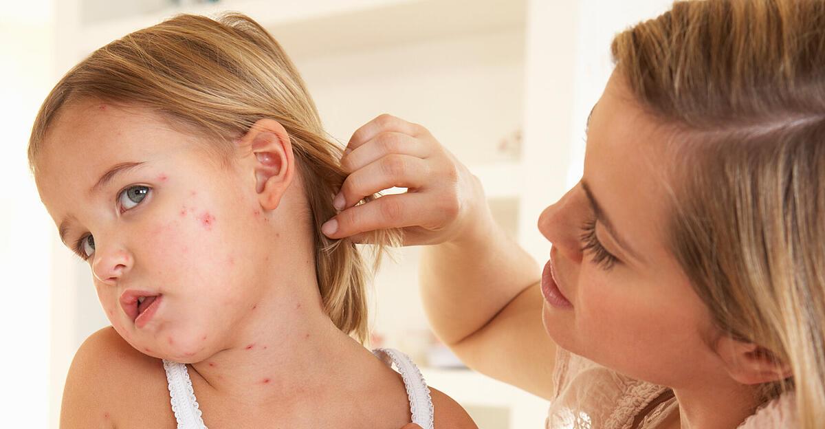 Measles: | “Highly contagious and potentially life-threatening”