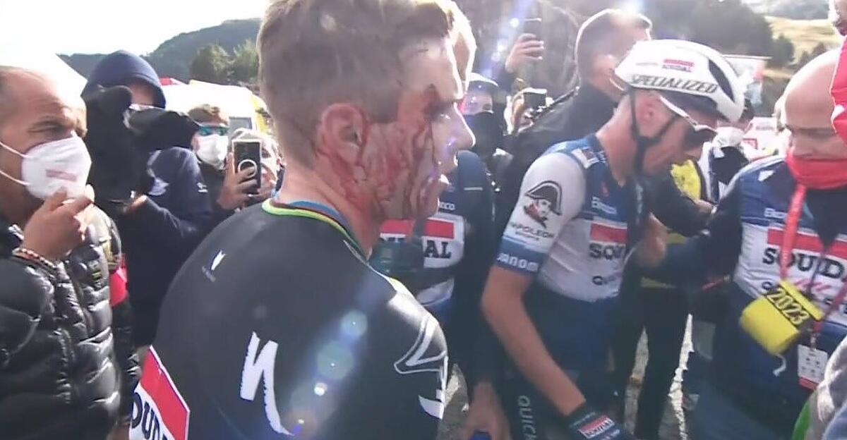 Bleeding wound: ex-world champion collides with a journalist after winning the Vuelta