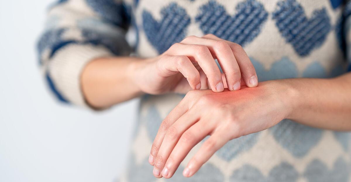 Atopic dermatitis: When the itching never stops